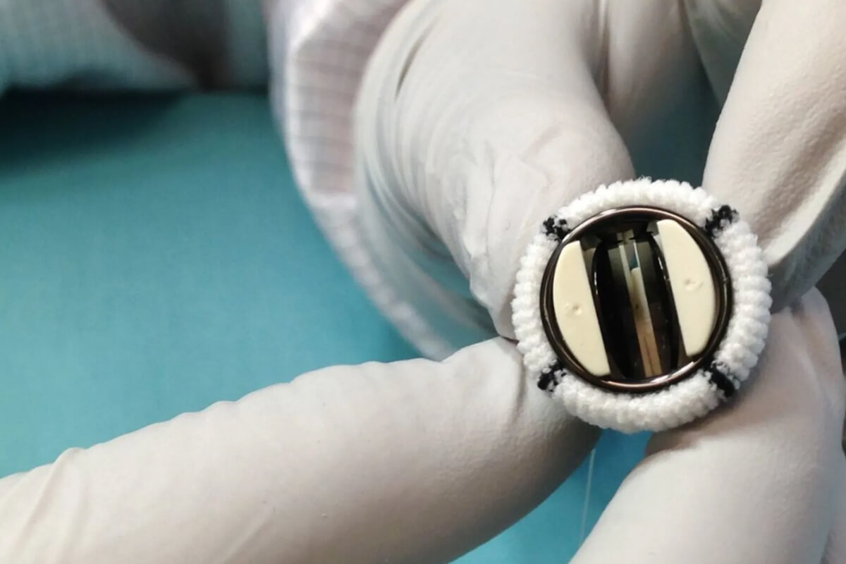 Mekanik Kapak Protezinin Avantajları ve Dezavantajları