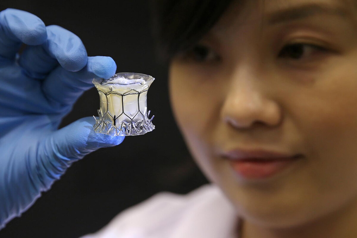 Mekanik Kapak Protezi Hangi Durumlarda Tercih Edilir?