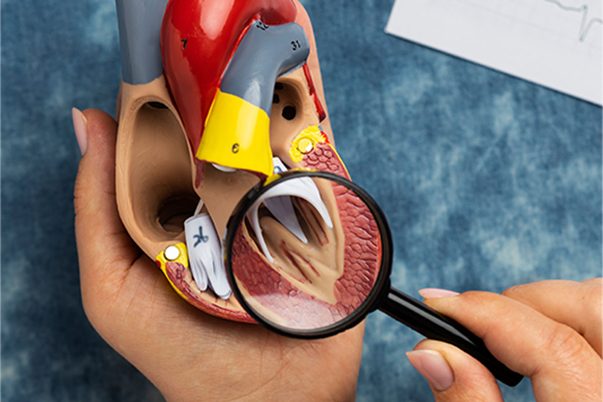 Patent Foramen Ovale’nin (PFO) Potansiyel Komplikasyonları​